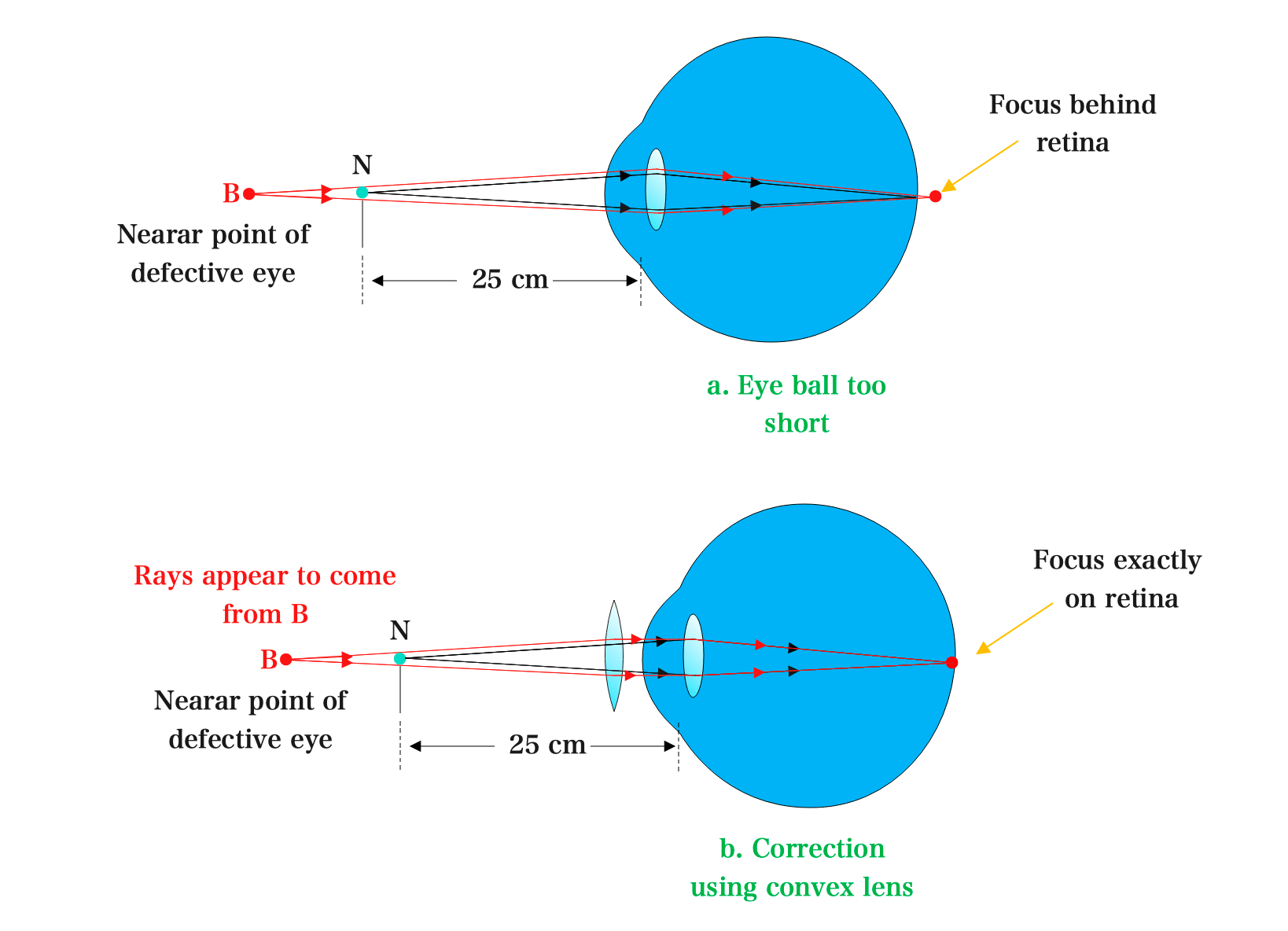 Defects Of The Eye And Its Correction | Kofa Study