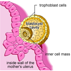 implantation